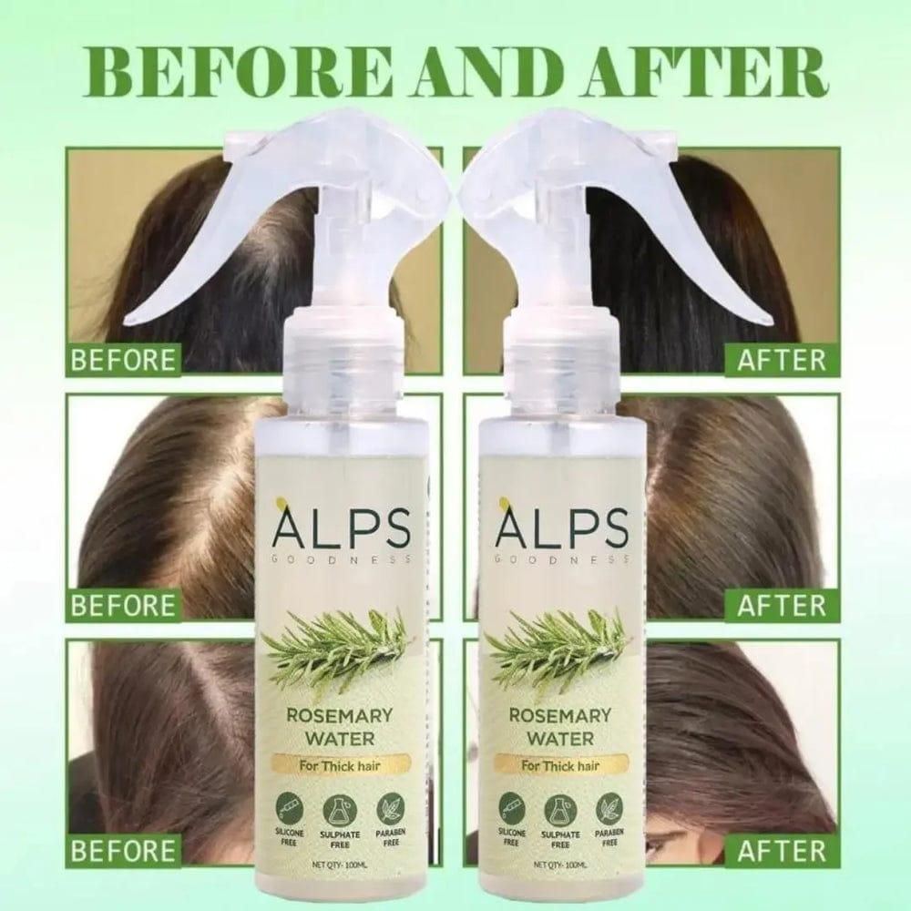 Rosemary Water Hair - Sprayer For Hair Care & Regrowth